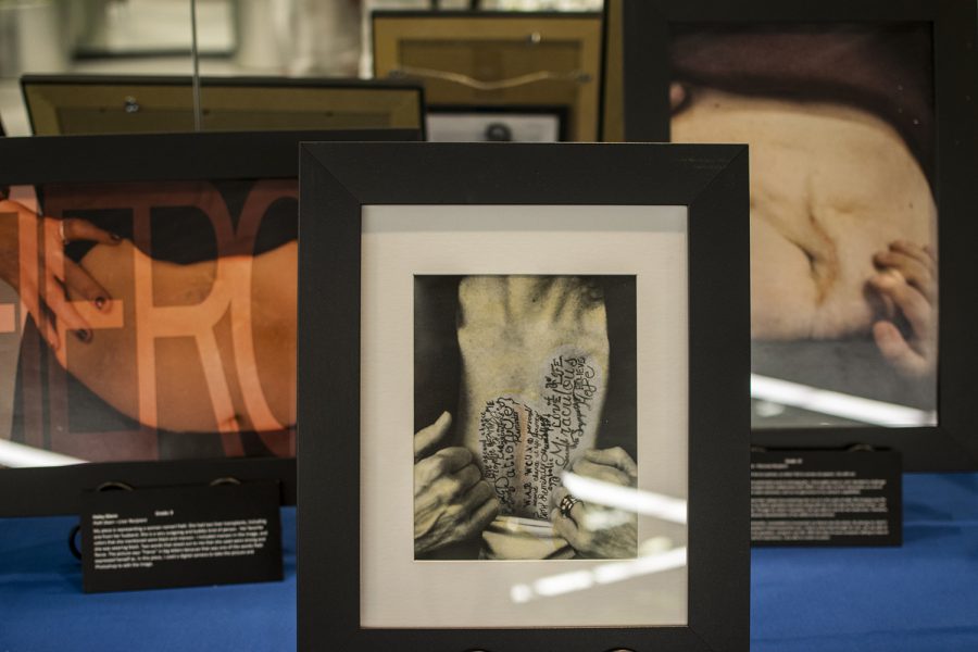 Pictures at the Art of the SCAR is seen on Tuesday, Sept. 11, 2018. It is a traveling exhibition starring transplants recipients and living donors.