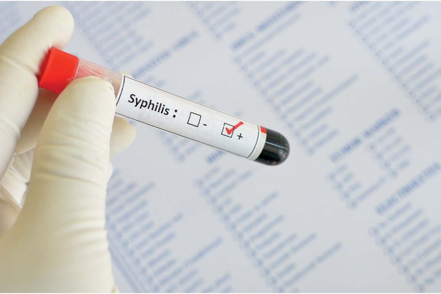 Cases of syphilis up 75 percent in Iowa
