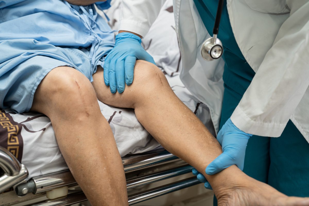 Guest Opinion | The Doctor is in: Preventing ACL injuries