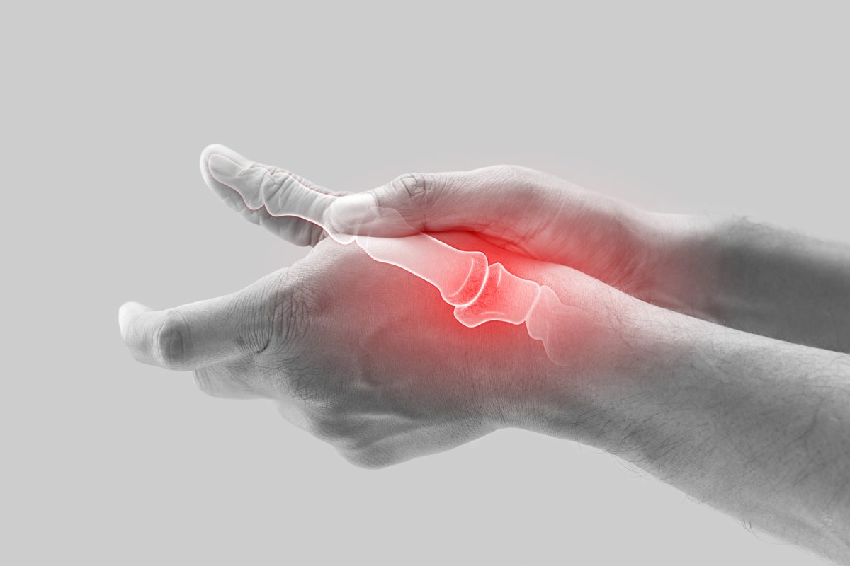 UI researchers receive $2.7 million grant to continue knee osteoarthritis study