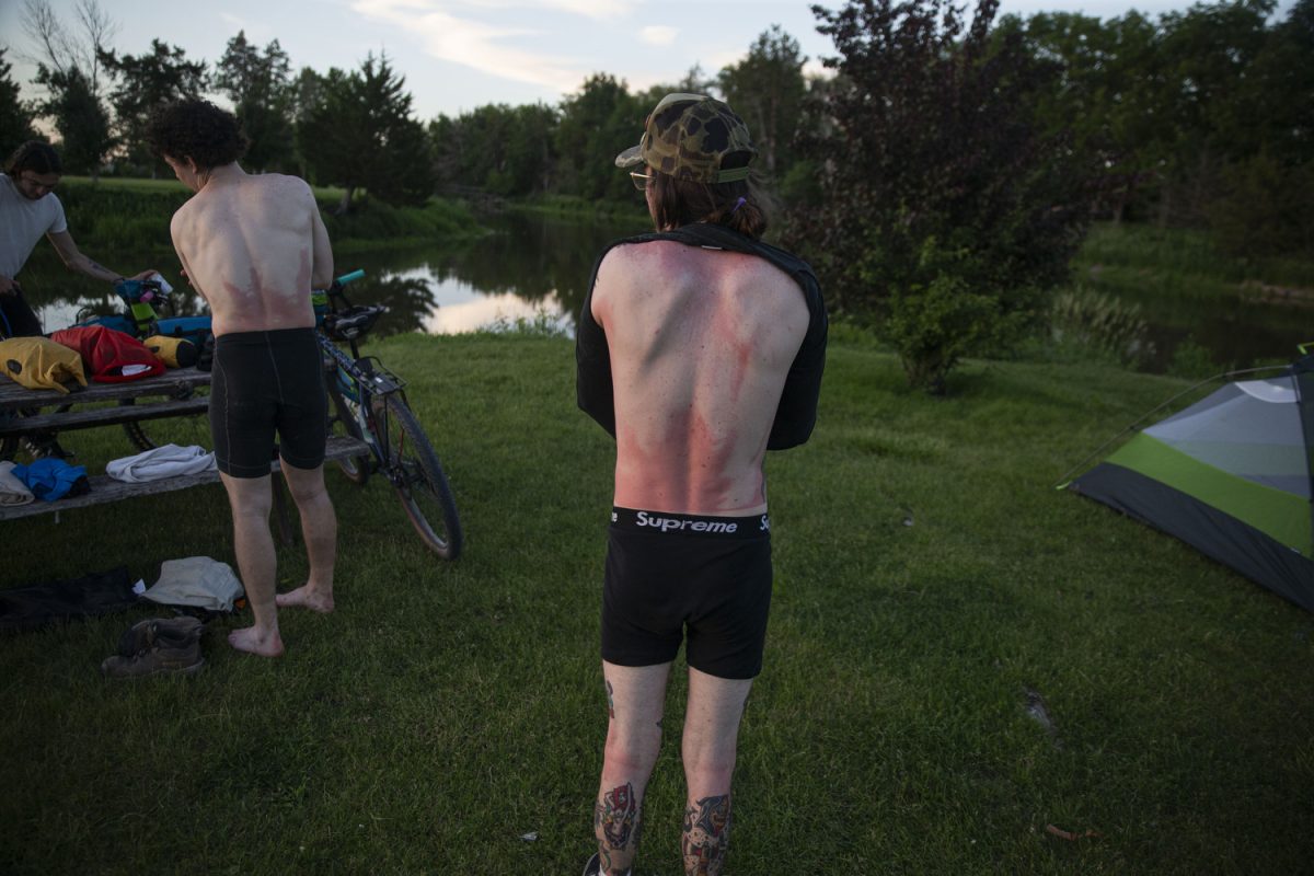 Carter Russell shows off his sunburned skin at Griswold Fish Farm Park and Campground north of Griswold, Iowa on Saturday, June 1, 2024. On day one of the Design, Build and Ride Iowa bicycle tour, participants covered 75 miles with over 2,700 vertical feet of climbing. 